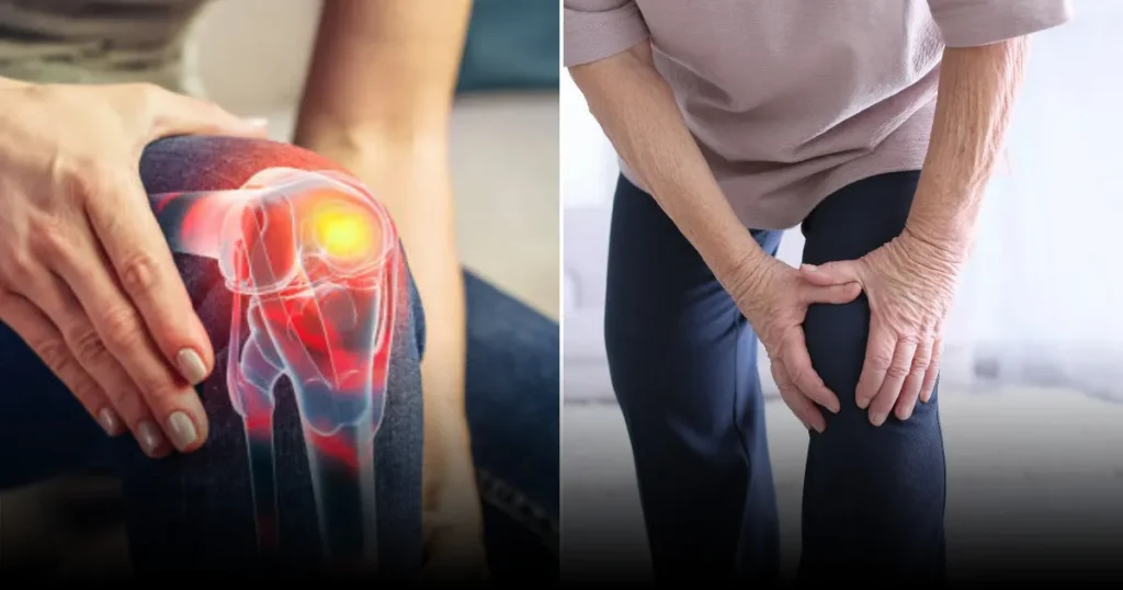 Почему низкокалорийные диеты вместе с тренировками разрушают кости